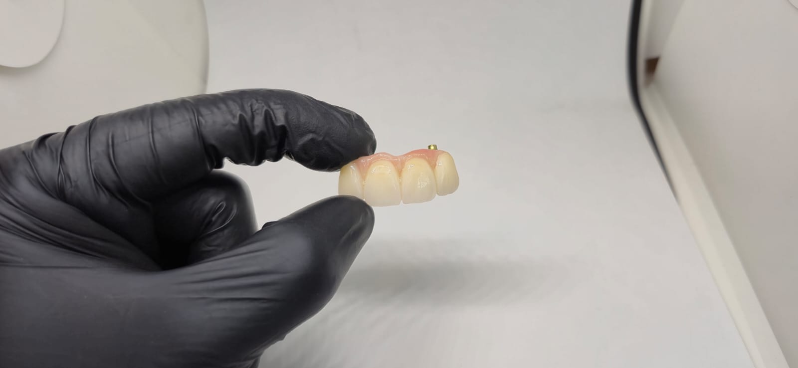 Implantes dentales