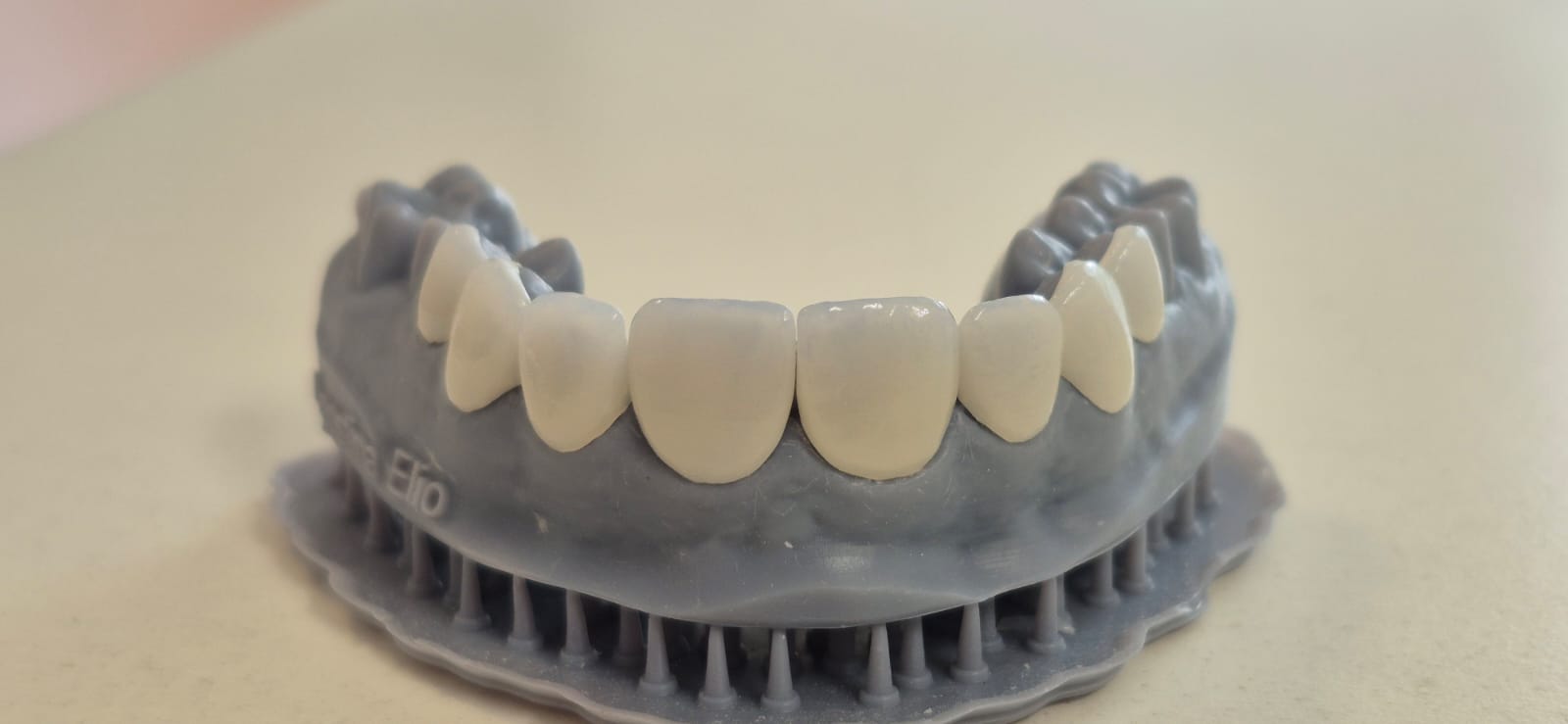Prótesis dentales