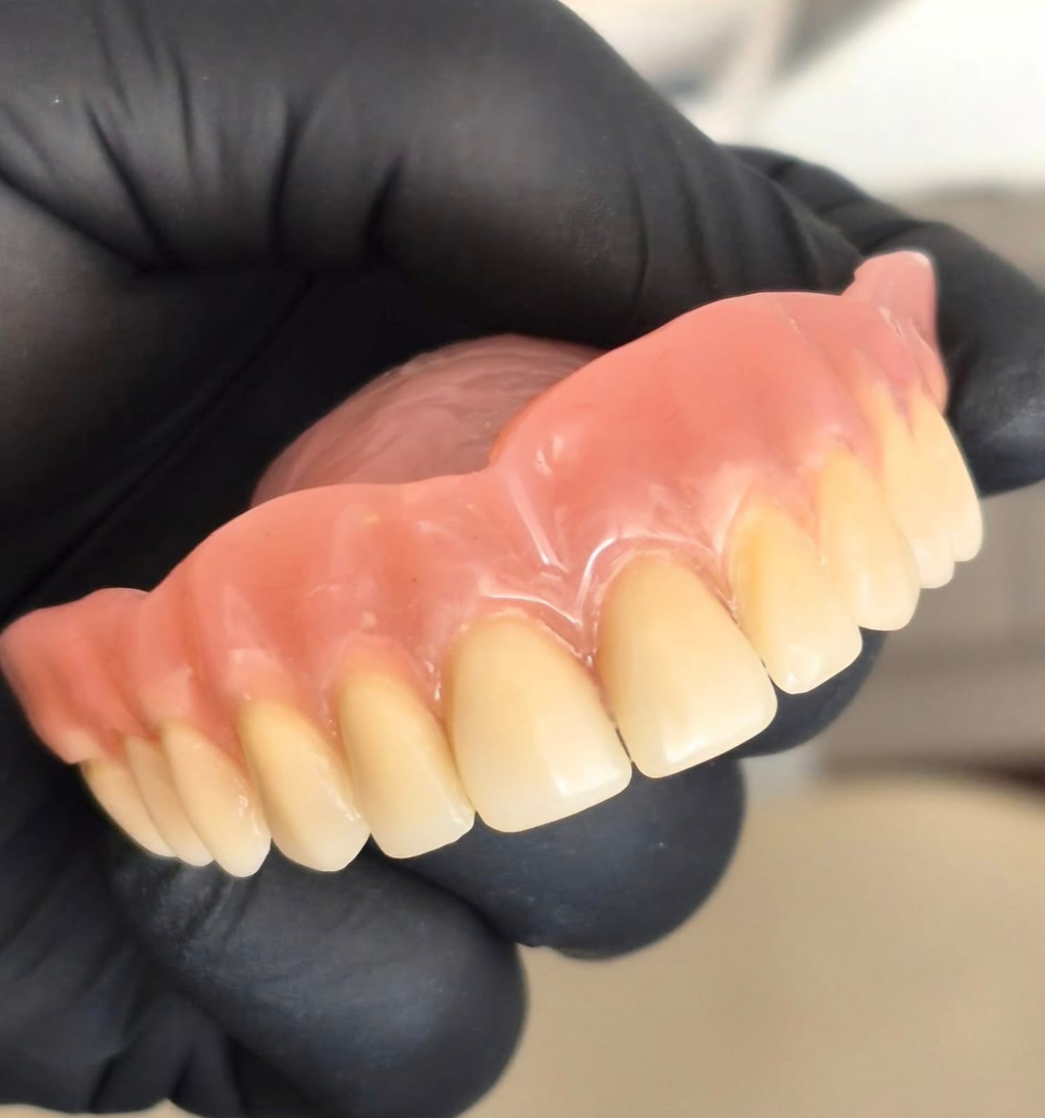 Restauraciones dentales
